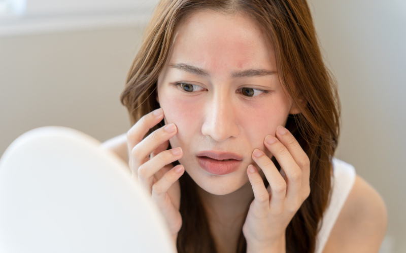 Da cháy nắng: Cách làm dịu và phục hồi