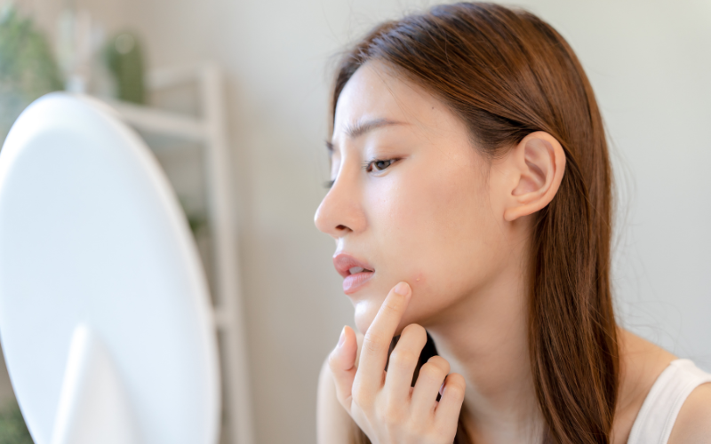 Lỗ chân lông to: Nguyên nhân và cách chăm sóc