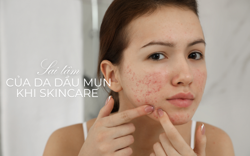 Coi nhẹ dưỡng ẩm – Sai lầm lớn nhất của da dầu mụn