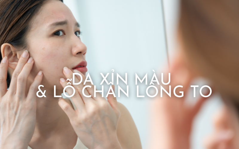 Cách cải thiện tình trạng da xỉn màu, lỗ chân lông to vào mùa Đông